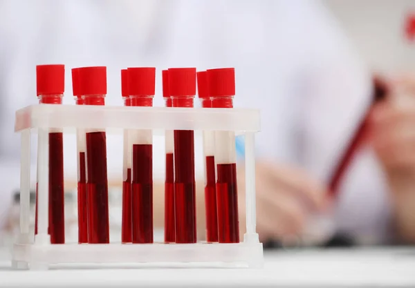 Биохимический анализ крови на выявление наркотиков и ПАВ