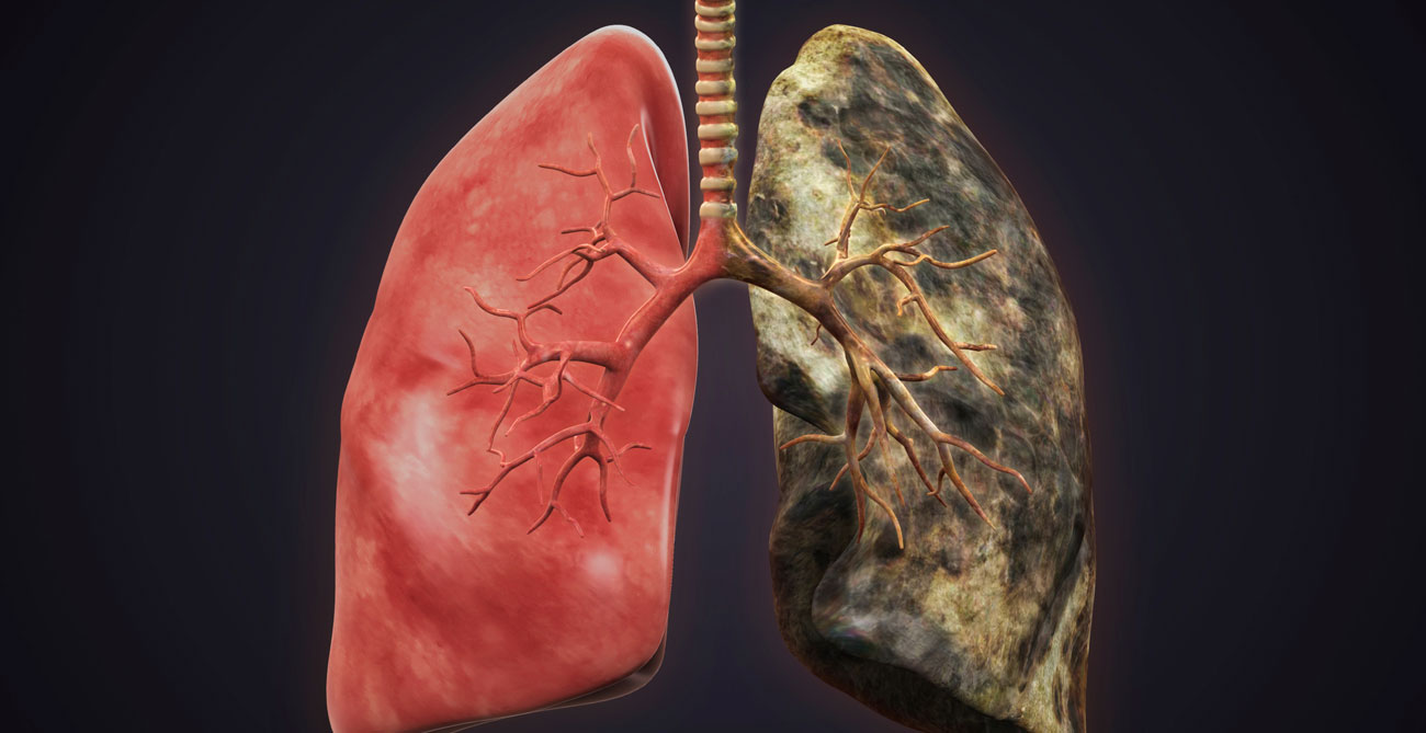 Курение и органы дыхания